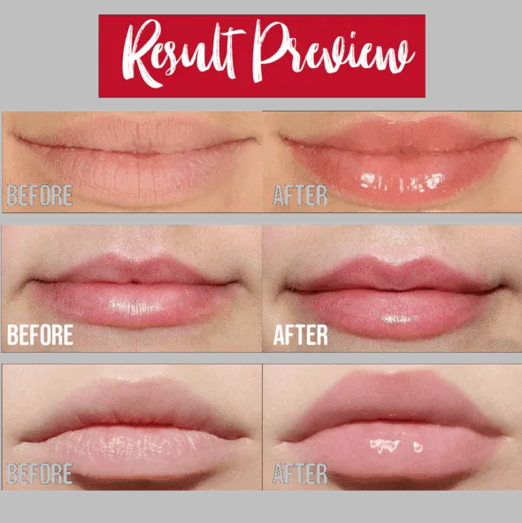 Instant Lip Plumping Serum