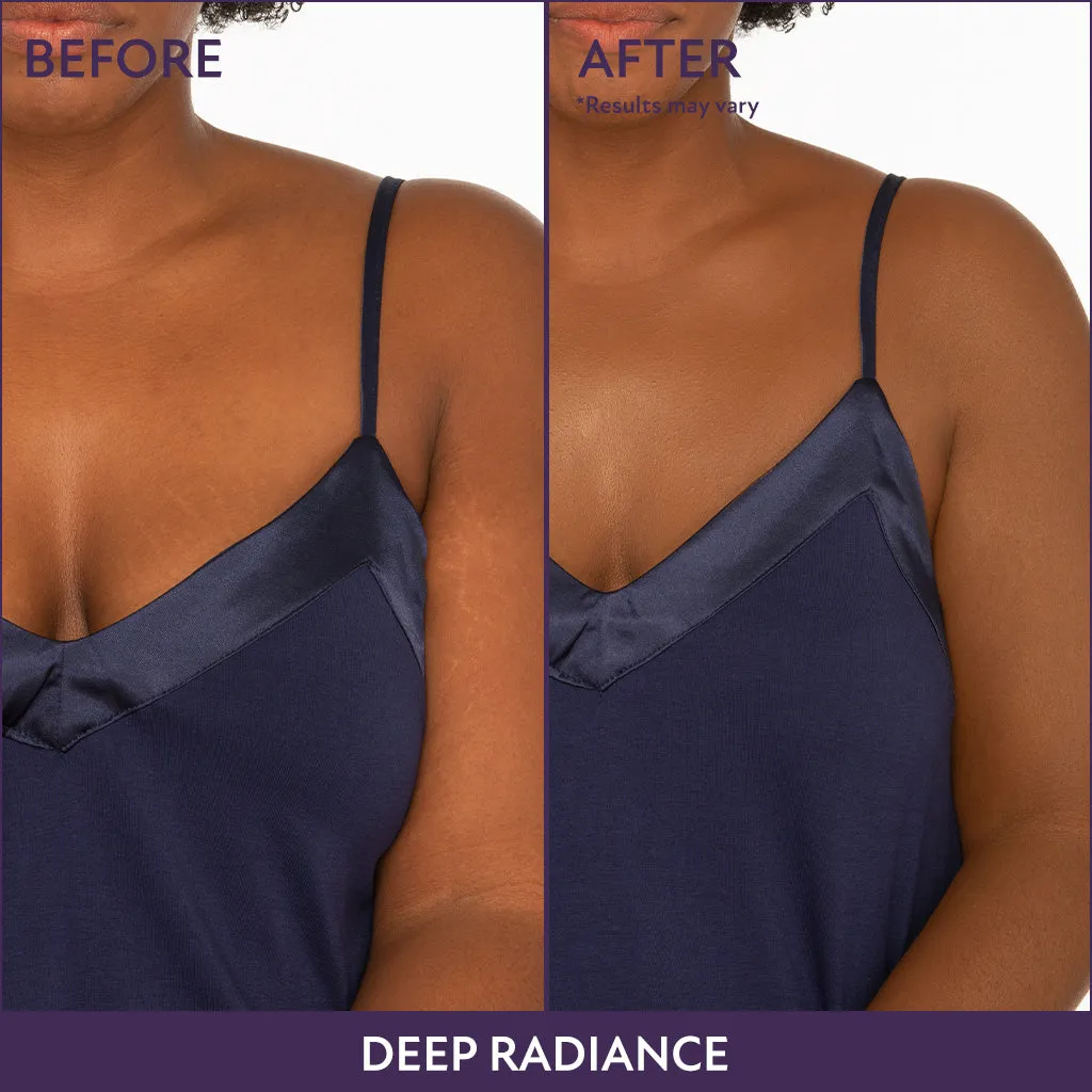 Limited Time 3.5oz Body Coverage Bundle