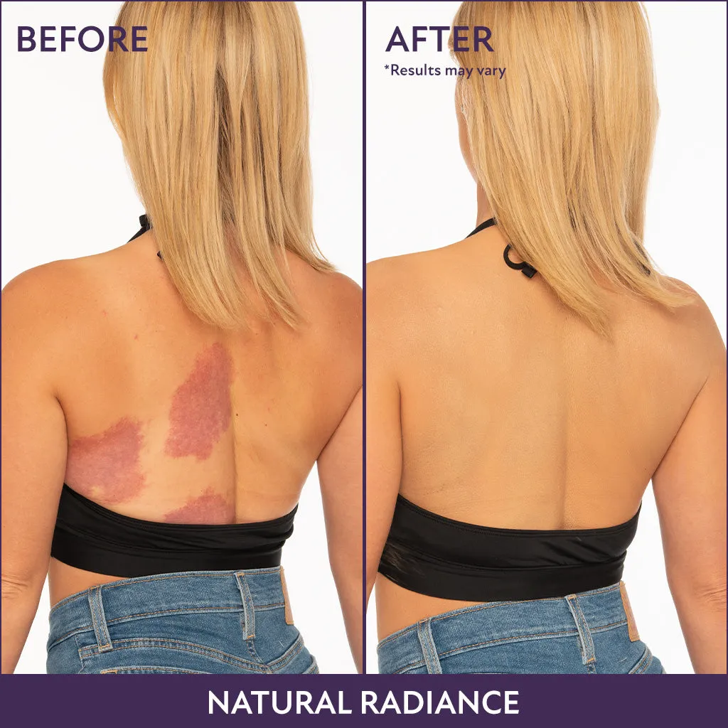 Limited Time 3.5oz Body Coverage Bundle